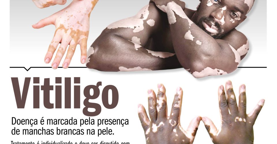PAG1